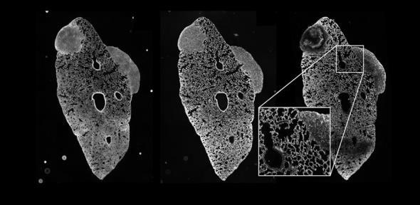 Read more about the article Cancer researchers and astronomers join forces in fight against disease