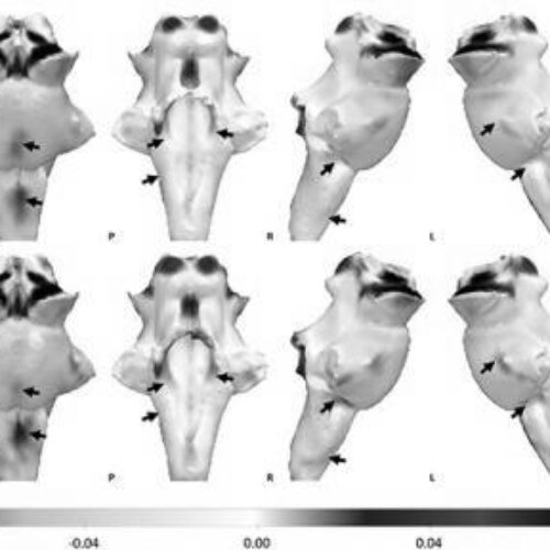 Ultra-powered MRI scans show damage to brain’s ‘control centre’ is behind long-lasting Covid-19 symptoms