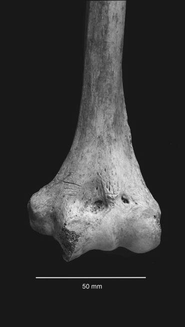 Close up of the end of a humerus bone from the Early Bronze Age showing damage and cutmarks.